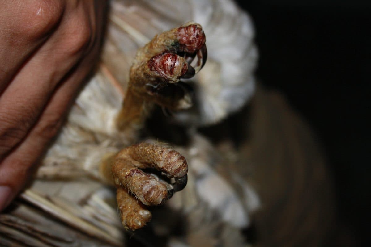 Close-up of infected foot with tissue damage